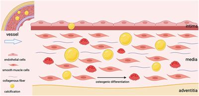 The Role of Sirtuins in Osteogenic Differentiation of Vascular Smooth Muscle Cells and Vascular Calcification